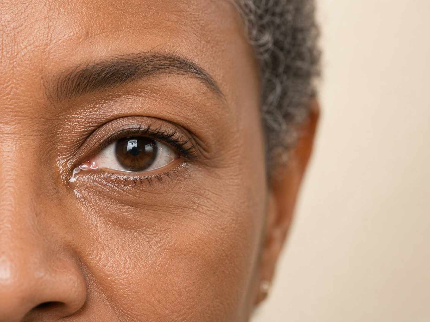 Close-up of a woman's watery eye